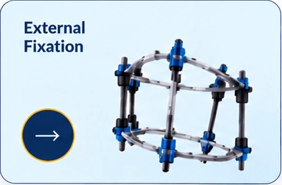 External Fixation illustrative category card
